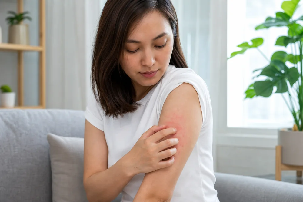 A young woman sitting on a sofa scratching a mildly red, itchy patch of skin on her upper arm